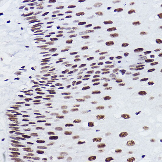 BRMS1 Antibody (5Y8J3)