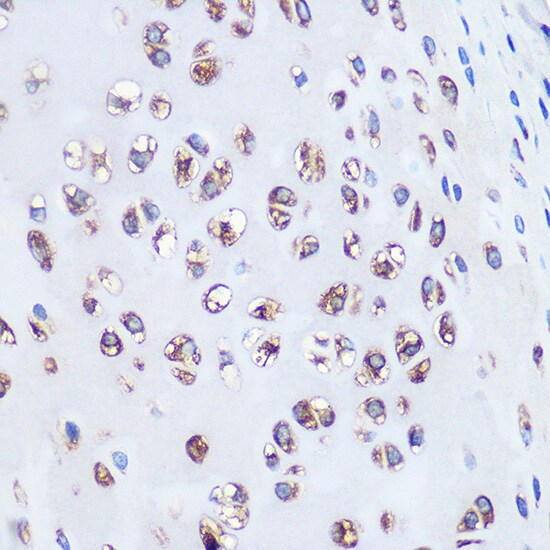 Aggrecan Antibody (6L4T2)