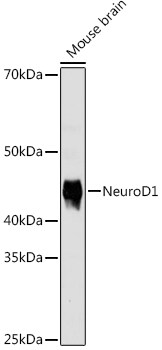 NeuroD1 Antibody (5V4L8)