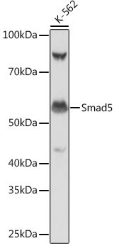Smad5 Antibody (1X5G9)