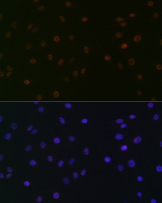 SUPT5H Antibody (9V9G7)