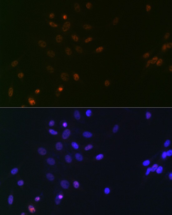 SUPT5H Antibody (9V9G7)