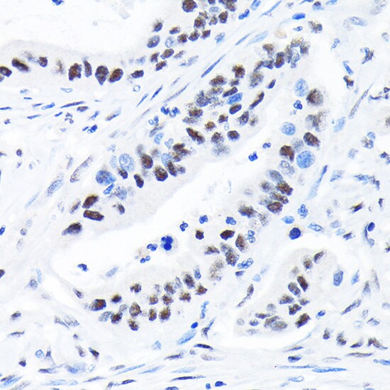 SUPT5H Antibody (9V9G7)