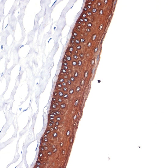 Cytokeratin 12 Antibody (2M1K10)