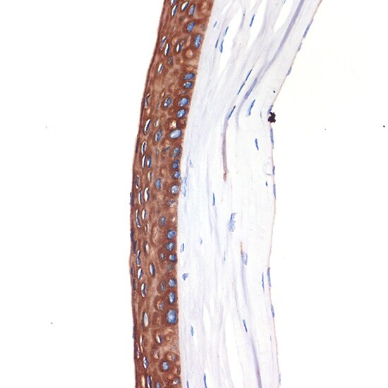 Cytokeratin 12 Antibody (2M1K10)