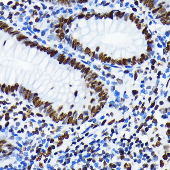 Histone H4 [ac Lys5] Antibody (10G1L0)