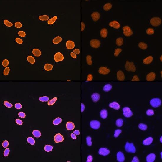 Histone H4 [ac Lys5] Antibody (10G1L0)