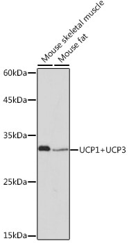 UCP1/3 Antibody (0S10O10)