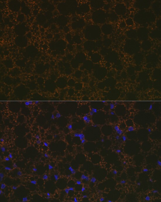 UCP1/3 Antibody (0S10O10)