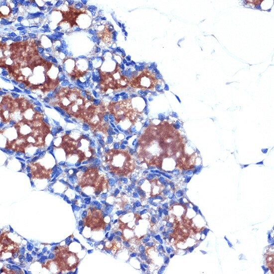 UCP1/3 Antibody (0S10O10)