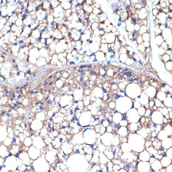 UCP1/3 Antibody (0S10O10)