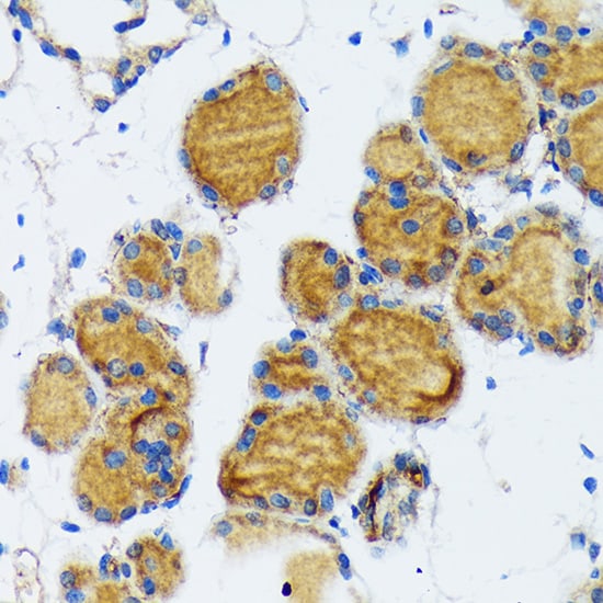 Thyroid Peroxidase Antibody (3C4A4)