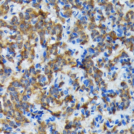 Thyroid Peroxidase Antibody (3C4A4)
