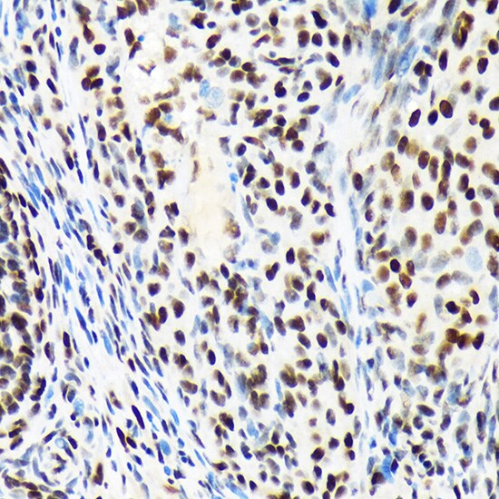 ARID1A Antibody (9D4J6)