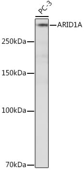 ARID1A Antibody (9D4J6)