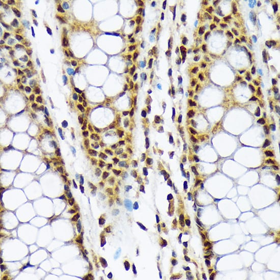 MAD2L1-binding protein Antibody (7W8H1)