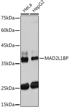 MAD2L1-binding protein Antibody (7W8H1)