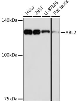 ABL2 Antibody (2L9C6)