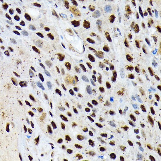 ENT2 Antibody (7B2J3)