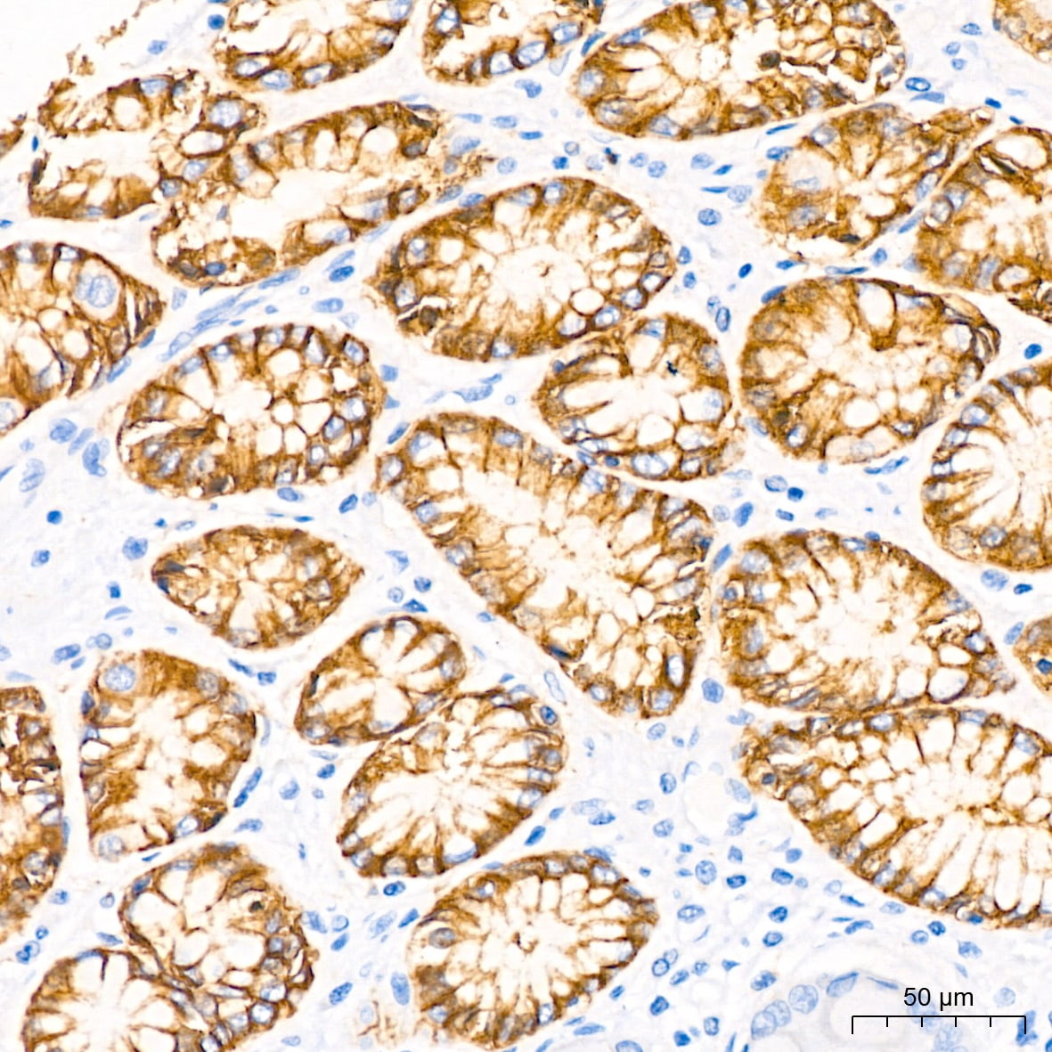 Claudin-18.2 Antibody (3J4G7)