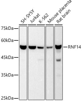 ARA54 Antibody (4X10Q6)