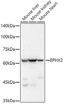 EPHX2 Antibody (8E2X2)