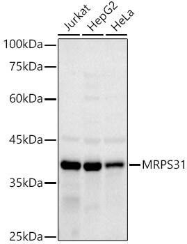 MRPS31 Antibody (3J3T5)