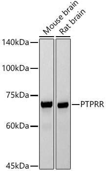 PCPTP1 Antibody (5R6L5)