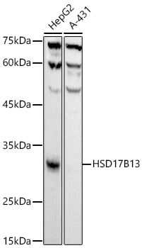 HSD17B13 Antibody (10T10L5)