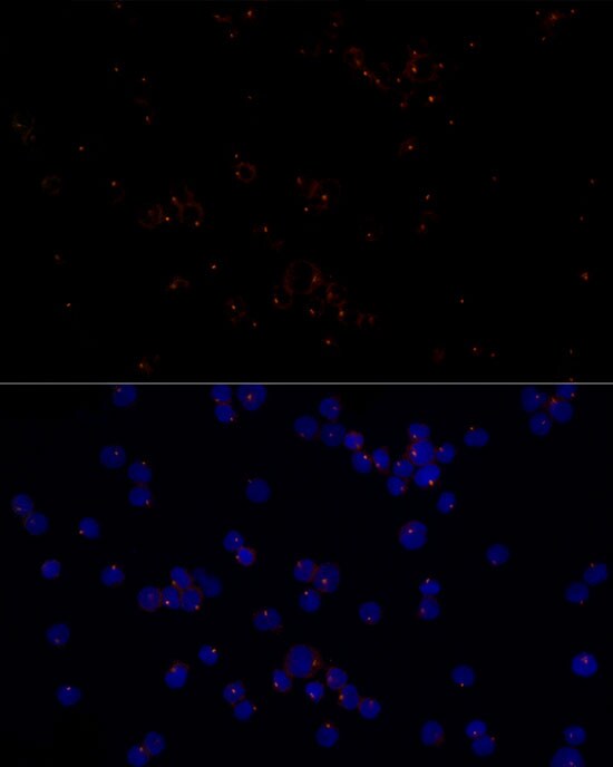 FGFR1OP Antibody (2T2F9)