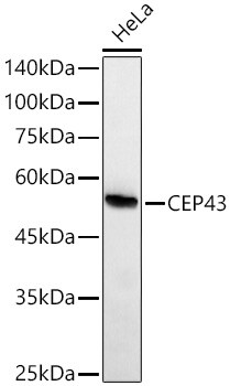FGFR1OP Antibody (2T2F9)