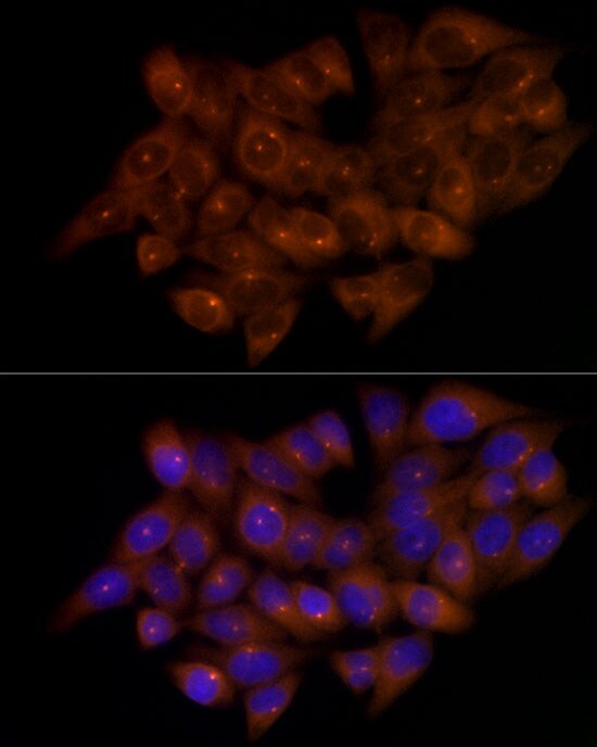 FGFR1OP Antibody (2T2F9)