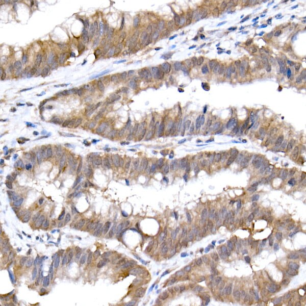 UbcH5a/UBE2D1 Antibody (8E6O0)