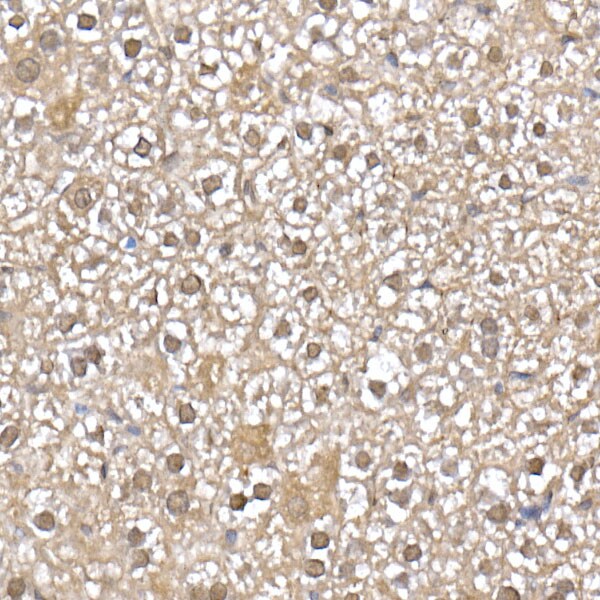 UbcH5a/UBE2D1 Antibody (8E6O0)