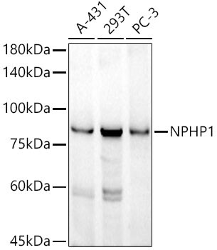 Nephronophthisis Antibody (6T10Z4)