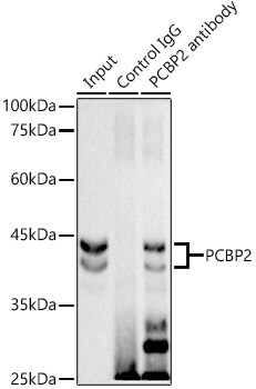 PCBP2 Antibody (4K6I6)