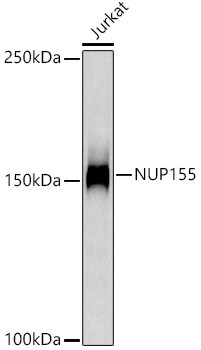 NUP155 Antibody (9I10M5)
