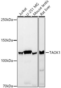 TAO Kinase 1 Antibody (6L4S9)