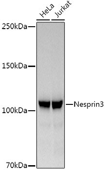 Nesprin-3 Antibody (5P10J3)