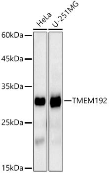 TMEM192 Antibody (9R8Z7)