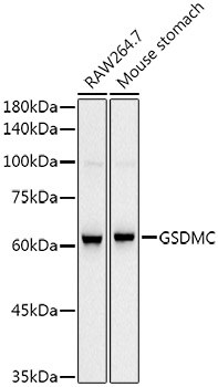 Gasdermin-C Antibody (1G8H5)