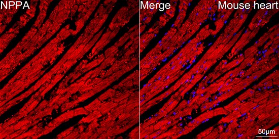 Atrial Natriuretic Peptide/ANP Antibody (2C5S5)