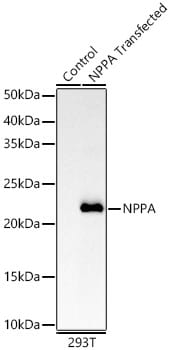 Atrial Natriuretic Peptide/ANP Antibody (2C5S5)