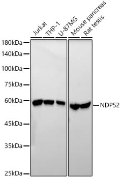 NDP52 Antibody (5O8Y6)