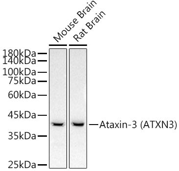 Ataxin-3 Antibody (7B2I1)