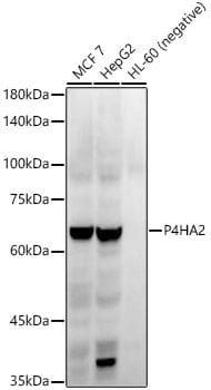 P4HA2 Antibody (6A6Z2)
