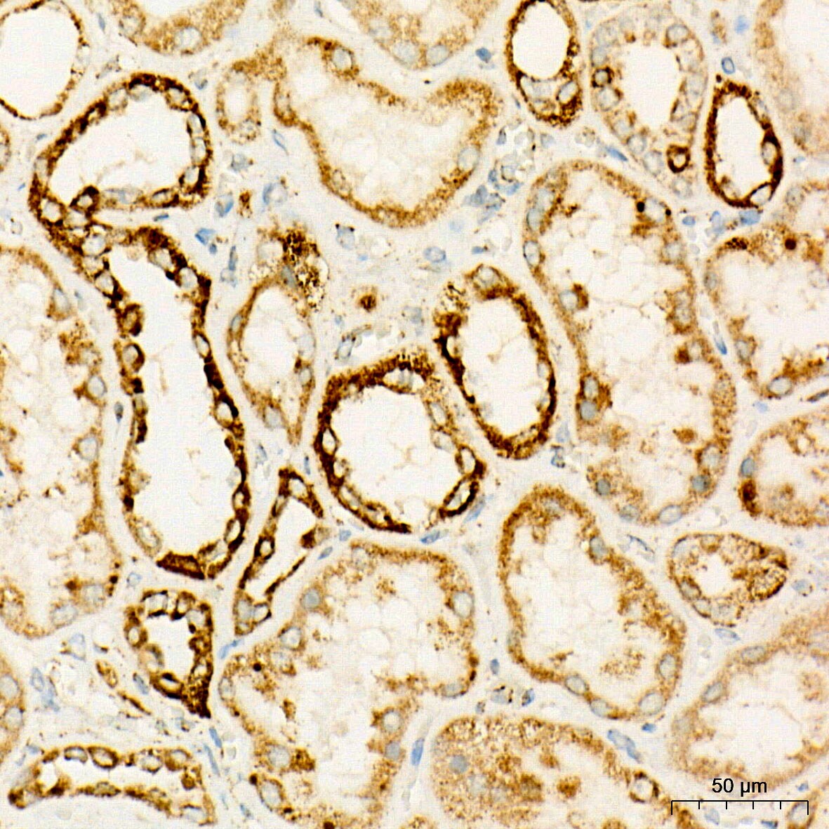 OGDH Antibody (4O7N7)