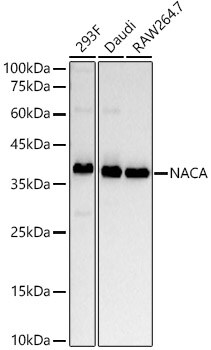 NACA1 Antibody (9S6U3)