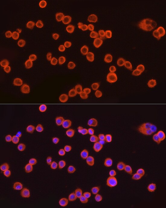 CMTM6 Antibody (7N3H5)