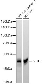 SETD6 Antibody (1Q1Z3)